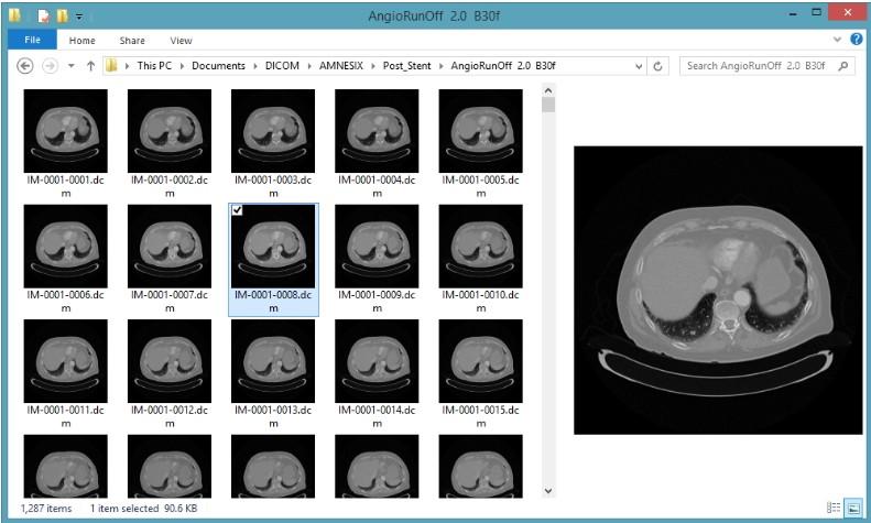 DICOM Thumbnailer下载,dicom缩略图查看工具,图片浏览,图片查看